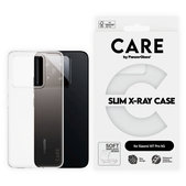 Hülle X-Ray für Xiaomi 15T Pro 5G, transparent, CARE
